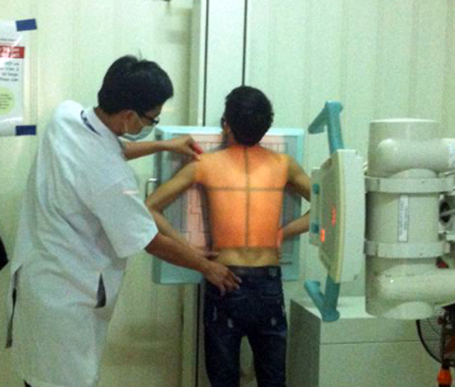 Chụp X.quang phổi cho bệnh nhân lao tại Trung tâm phòng chống bệnh xã hội.