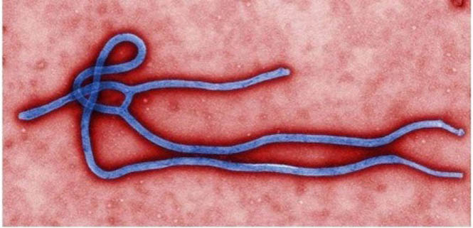 Vi rút Ebola.