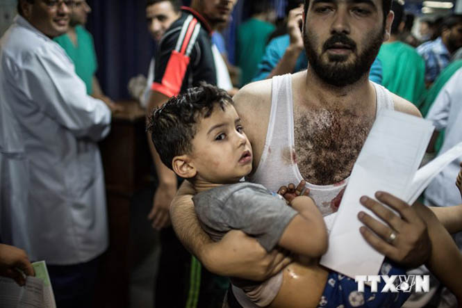 Một trẻ em Palestine bị thương trong vụ không kích của máy bay Israel ở Dải Gaza ngày 19-8. (Nguồn: THX/TTXVN)