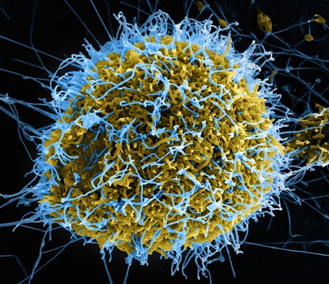 Hình ảnh phóng đại bằng kính hiển vi điện tử của virus Ebola đang phát triển khỏi tế bào VERO 46 bị nhiễm.