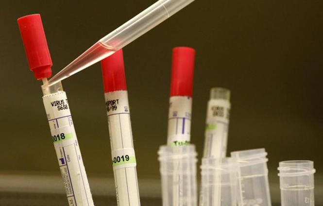 Thuốc thử nghiệm ZMapp, niềm hy vọng trong việc tiêu diệt virus Ebola