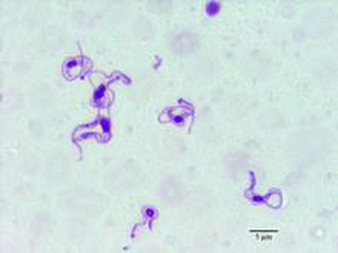 Trùng roi Trypanosoma evansi (Nguồn: digplanet)