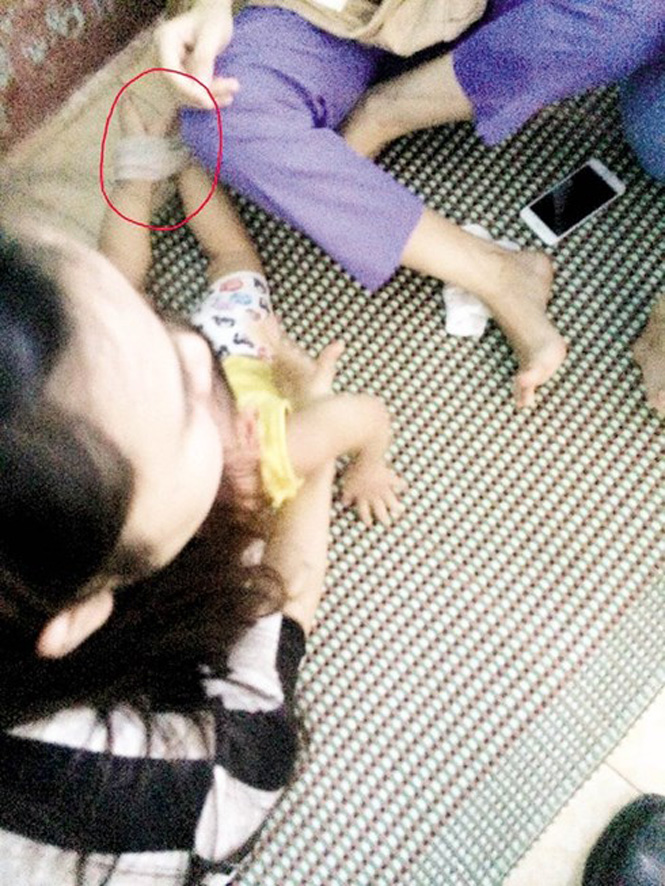  Hình ảnh cháu bé bị các cô giáo bạo hành tại cơ sở Sơn Ca (TP Đồng Hới)