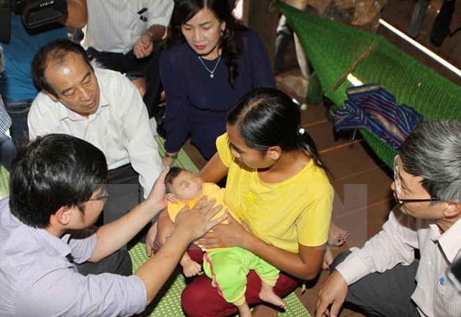 Đoàn công tác của Bộ Y tế thăm khám cho bệnh nhi bị dị tật đầu nhỏ vào ngày 18-10. (Ảnh: Dương Giang/TTXVN)