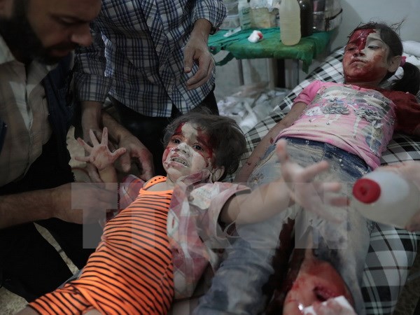 Trẻ em bị thương trong xung đột giữa quân Chính phủ Syria và lực lượng nổi dậy ở thị trấn Douma, phía Đông thủ đô Damascus. (Nguồn: AFP/TTXVN)