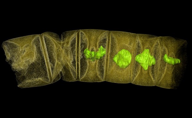 Ảnh chụp tia X hóa thạch giống tảo đỏ. (Nguồn: Reuters)