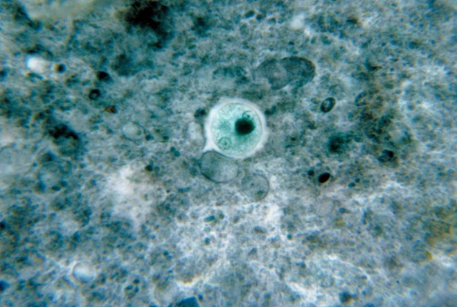 Đơn bào Entamoeba histolytica. (Nguồn: wikipedia.org)