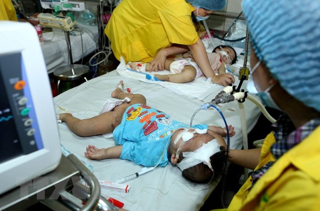 Điều trị cho trẻ em mắc bệnh sởi tại Bệnh viện Bệnh nhiệt đới Trung ương. (Ảnh: Qúy Trung/TTXVN)
