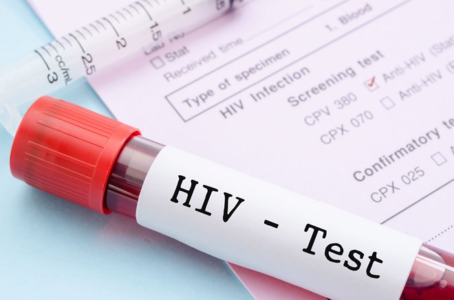 Thử nghiệm thành công giai đoạn đầu vắcxin mới phòng HIV/AIDS