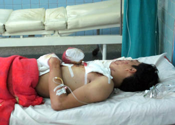 Anh P. V. V đang được điều trị tại Bệnh viện Hữu nghị Việt Nam - Cu Ba Đồng Hới. Ảnh: Giang Sơn