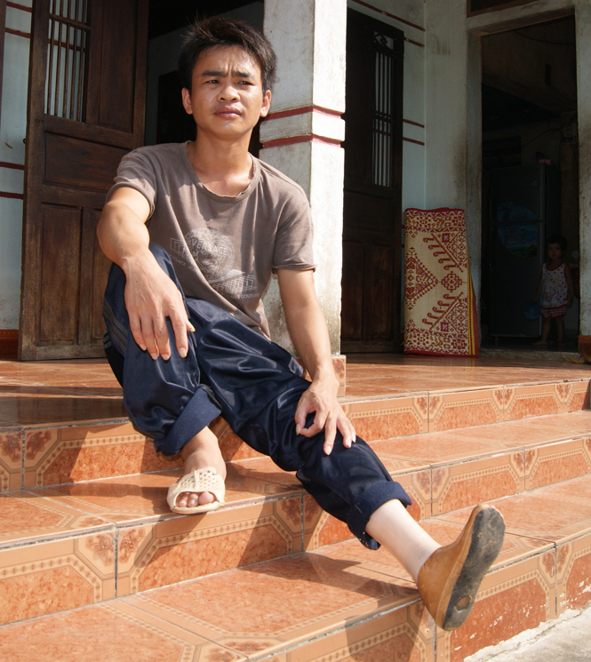 Anh Nguyễn Duy Thành, một trong những nạn nhân của việc lưu thông trên cầu đường sắt Sông Ngang.