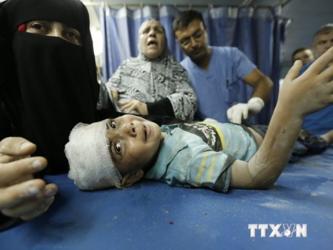 Em bé Palestine bị thương trong cuộc không kích của Israel tại bệnh viện ở Gaza ngày 4-8. (Ảnh: AFP/TTXVN)