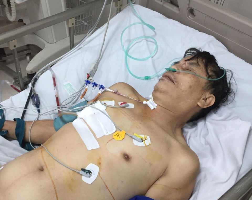 Bệnh nhân Doãn Xuân Khóa đang tiếp tục được điều trị tích cực tại Bệnh viện Hữu nghị Việt Nam – Cu Ba Đồng Hới.