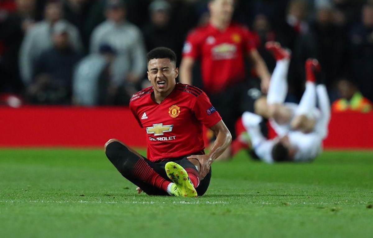 Lingard dính chấn thương. (Nguồn: Getty Images)