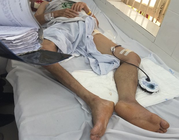  Một bệnh nhân mắc bệnh Whitmore đã được điều trị thành công tại Bệnh viện Bạch Mai. (Ảnh: PV/Vietnam+)