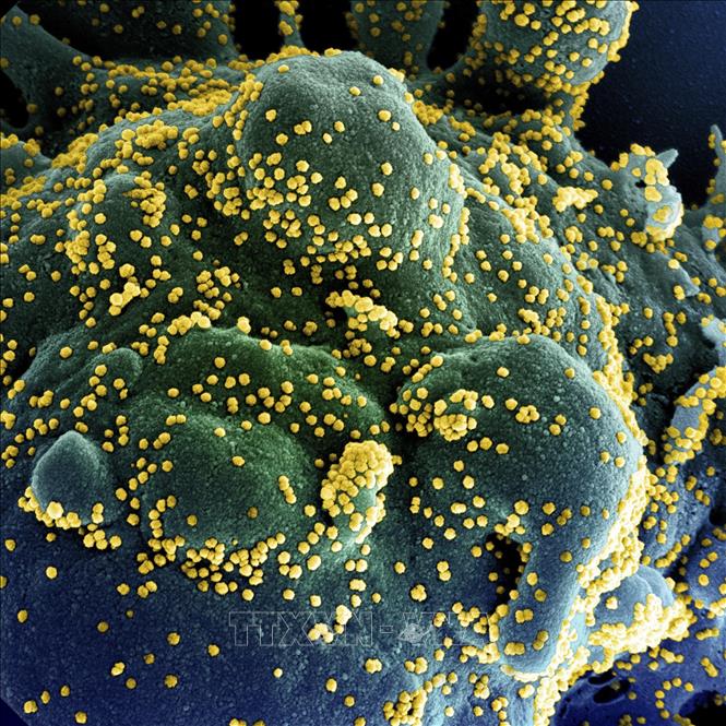 Hình ảnh quét qua kính hiển vi điện tử cho thấy một tế bào (màu xanh) bị virus SARS-COV-2 (màu vàng) xâm nhập, lấy từ mẫu bệnh phẩm của bệnh nhân COVID-19 tại Viện Nghiên cứu Dị ứng và Bệnh Truyền nhiễm Quốc gia, Fort Detrick, Maryland, Mỹ ngày 15-7-2020. Ảnh: AFP/TTXVN