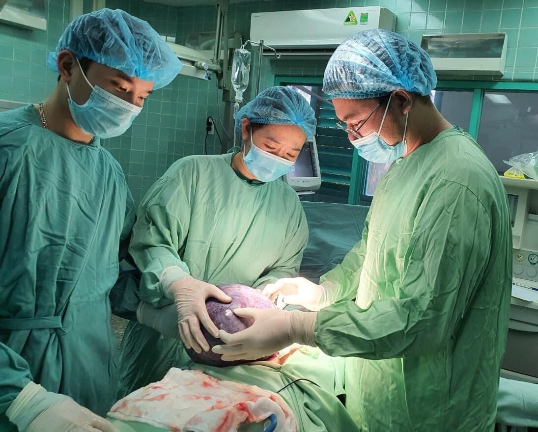  Kíp phẫu thuật tiến hành cắt khối u nang buồng trứng nặng gần 5 kg.