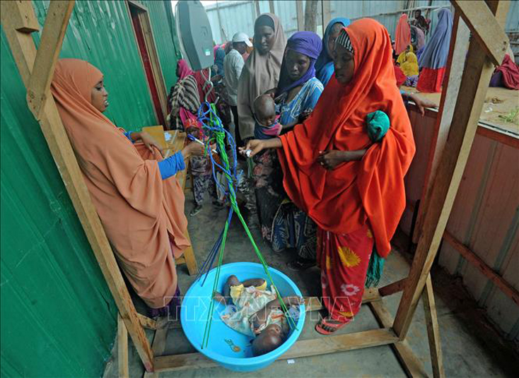 Trẻ em bị suy dinh dưỡng do thiếu lương thực tại khu vực ngoại ô Mogadishu, Somalia. Ảnh: AFP/TTXVN