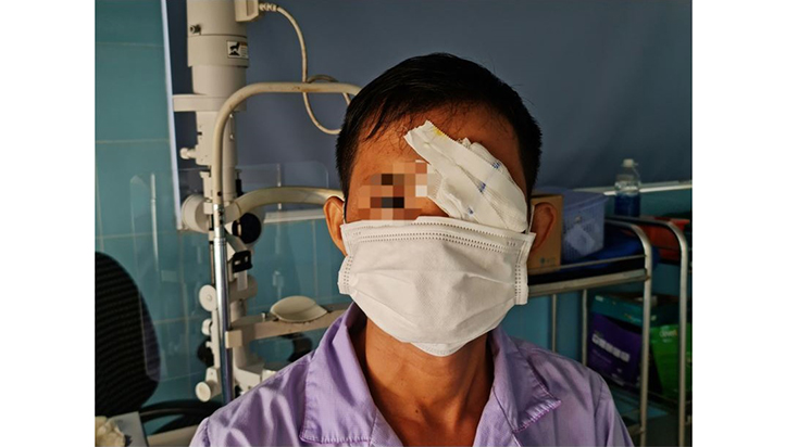 (QBĐT) - Các bác sĩ Khoa Mắt, Bệnh viện hữu nghị Việt Nam-Cuba Đồng Hới vừa tiến hành phẫu thuật cấp cứu thành công cho một bệnh nhân nam bị cò mổ thủng mắt. Hiện tại, bệnh nhân trong tình trạng ổn định, vết thương mắt đang phục hồi dần.