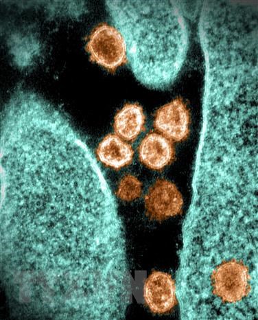 Hình ảnh virus SARS-CoV-2 chụp qua kính hiển vi điện tử tại phòng thí nghiệm ở Hamilton, Montana, Mỹ, ngày 28-6. (Ảnh: AFP/TTXVN)