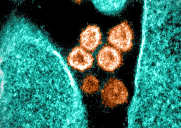 Hình ảnh virus SARS-CoV-2 chụp qua kính hiển vi điện tử tại phòng thí nghiệm ở Hamilton, Montana (Mỹ), ngày 28-6-2021. (Ảnh: AFP/TTXVN)