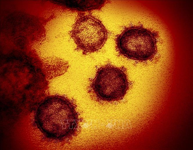 Hình ảnh dưới kính hiển vi từ viện y tế quốc gia Mỹ cung cấp cho thấy virus SARS-CoV-2 gây bệnh COVID-19 được phân lập và xuất hiện trên bề mặt tế bào của một bệnh nhân ở Mỹ. Ảnh: AFP/TTXVN