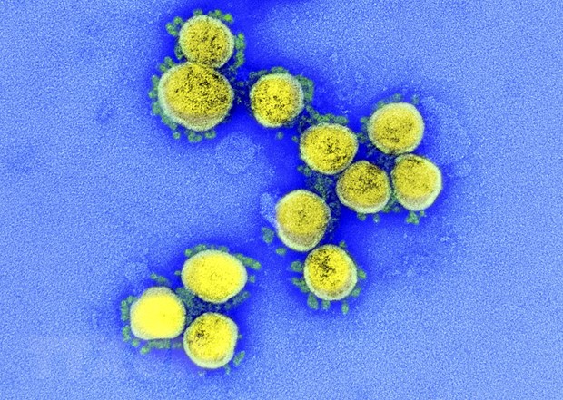 Hình ảnh từ kính hiển vi cho thấy virus SARS-CoV-2 trong mẫu bệnh phẩm của bệnh nhân. (Ảnh: AFP/TTXVN)
