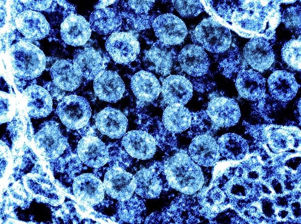  Hình ảnh qua kính hiển vi điện tử của virus SARS-CoV-2. (Ảnh: AFP/TTXVN)