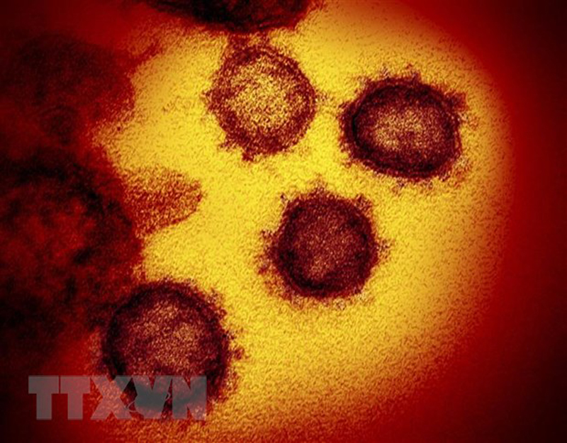 Hình ảnh biến thể Omicron của virus SARS-CoV-2 gây bệnh COVID-19 dưới kính hiển vi. (Ảnh: AFP/TTXVN)