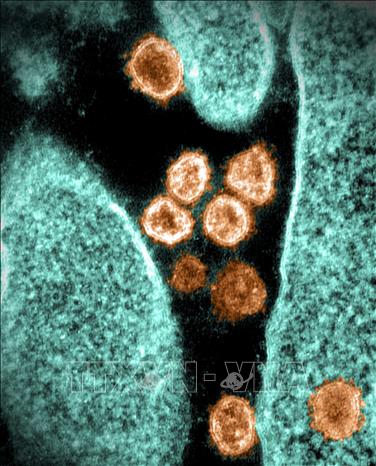 Hình ảnh virus SARS-CoV-2 chụp qua kính hiển vi điện tử tại phòng thí nghiệm ở Hamilton, Montana, Mỹ, ngày 28/6/2021. Ảnh: AFP/TTXVN