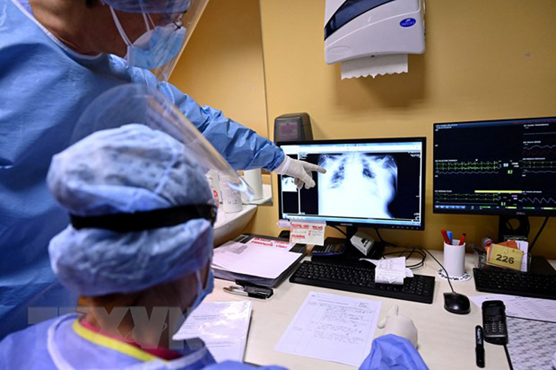 Nhân viên y tế theo dõi hình chụp X-quang phổi của bệnh nhân COVID-19 tại Rome, Italy. (Ảnh: AFP/TTXVN)
