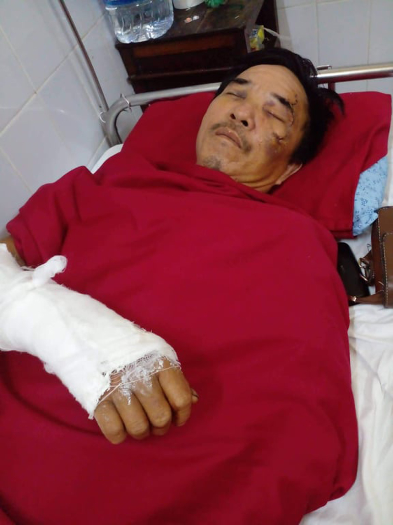 Bố Hà, ông Nguyễn Khắc Thông bị tai nạn nằm điều trị tại Huế hơn 2 tháng nay.