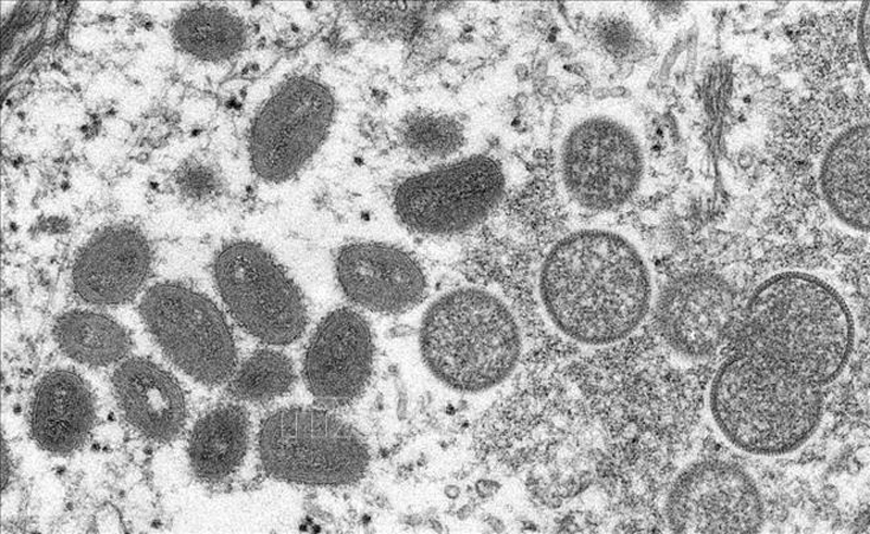 Hình ảnh dưới kính hiển vi cho thấy virus đậu mùa khỉ trong mẫu bệnh phẩm của một bệnh nhân. Ảnh: Reuters/TTXVN