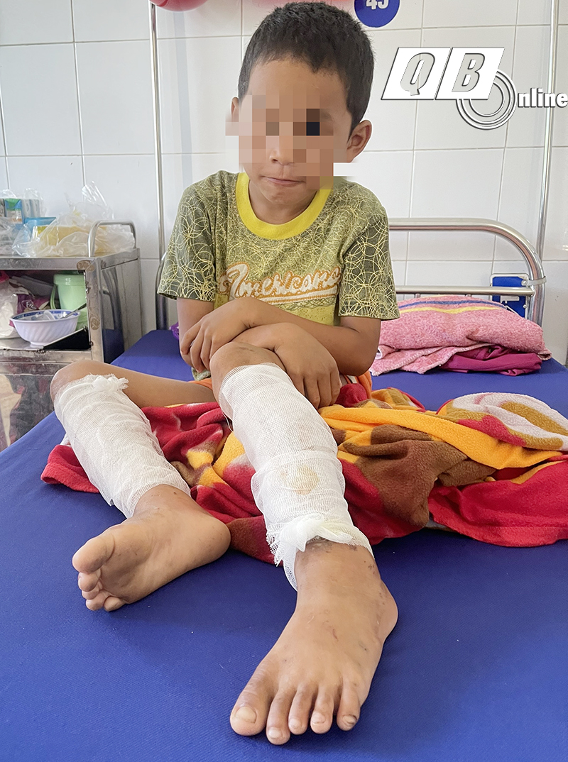 Cháu Nguyễn Tuấn T. đang điều trị tại Bệnh viện Đa khoa huyện Bố Trạch.