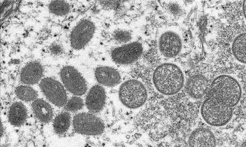 Hình ảnh virus đậu mùa khỉ dưới kính hiển vi điện tử. Ảnh: AFP/TTXVN