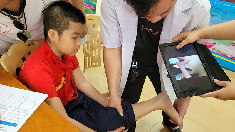 Các chuyên gia khám sàng lọc cho trẻ khuyết tật vận động. 